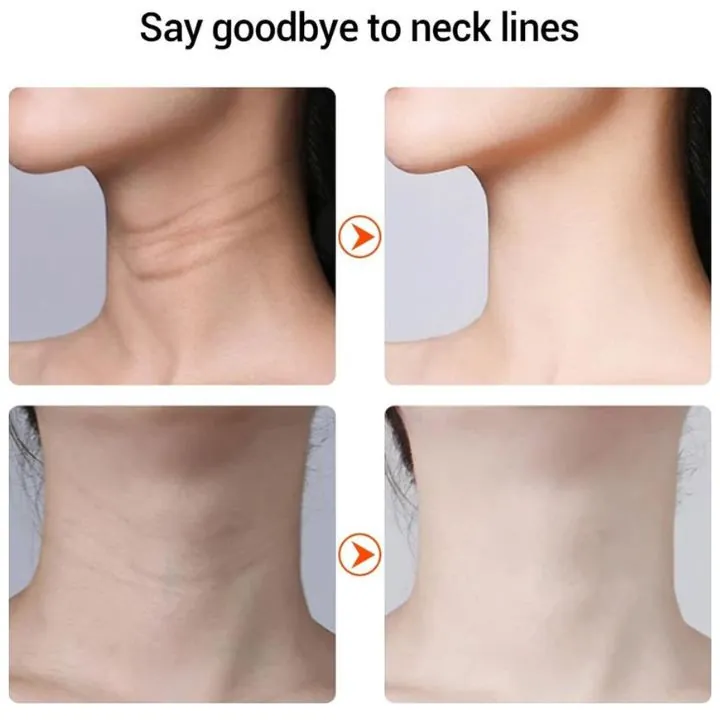 جهاز تجميل الرقبة وإزالة التجاعيد IPL Wrinkle Neck Beauty Device — 2