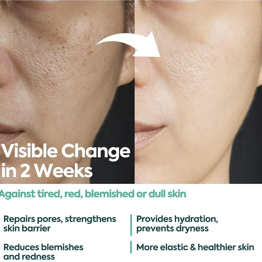 كلاسي كريم FACEUPSKIN المرمم للبشرة 40 مل — 2